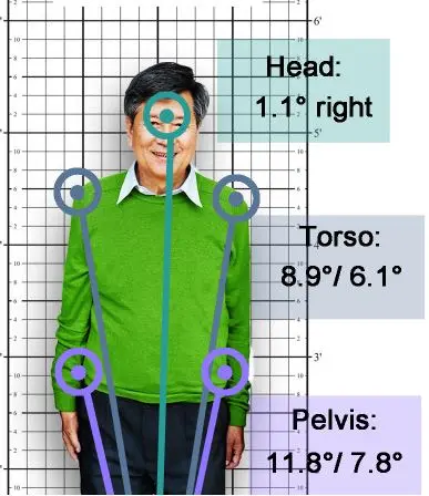 Auricoloterapia e Posturologia